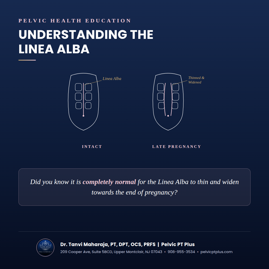 Diagram comparing an intact linea alba with the normal thinning and widening seen in late pregnancy